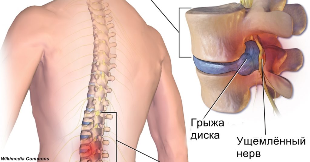 Боли в пояснице и тянет в заднем проходе Боли в пояснице и тянет в заднем проходе