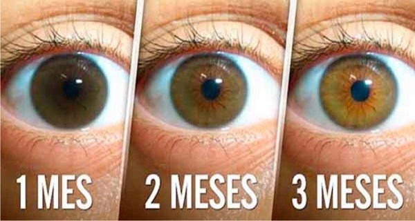 Естественный рецепт, чтобы победить катаракту и улучшить зрение всего за 3 месяца! Это очень просто! Избегайте хирургии!